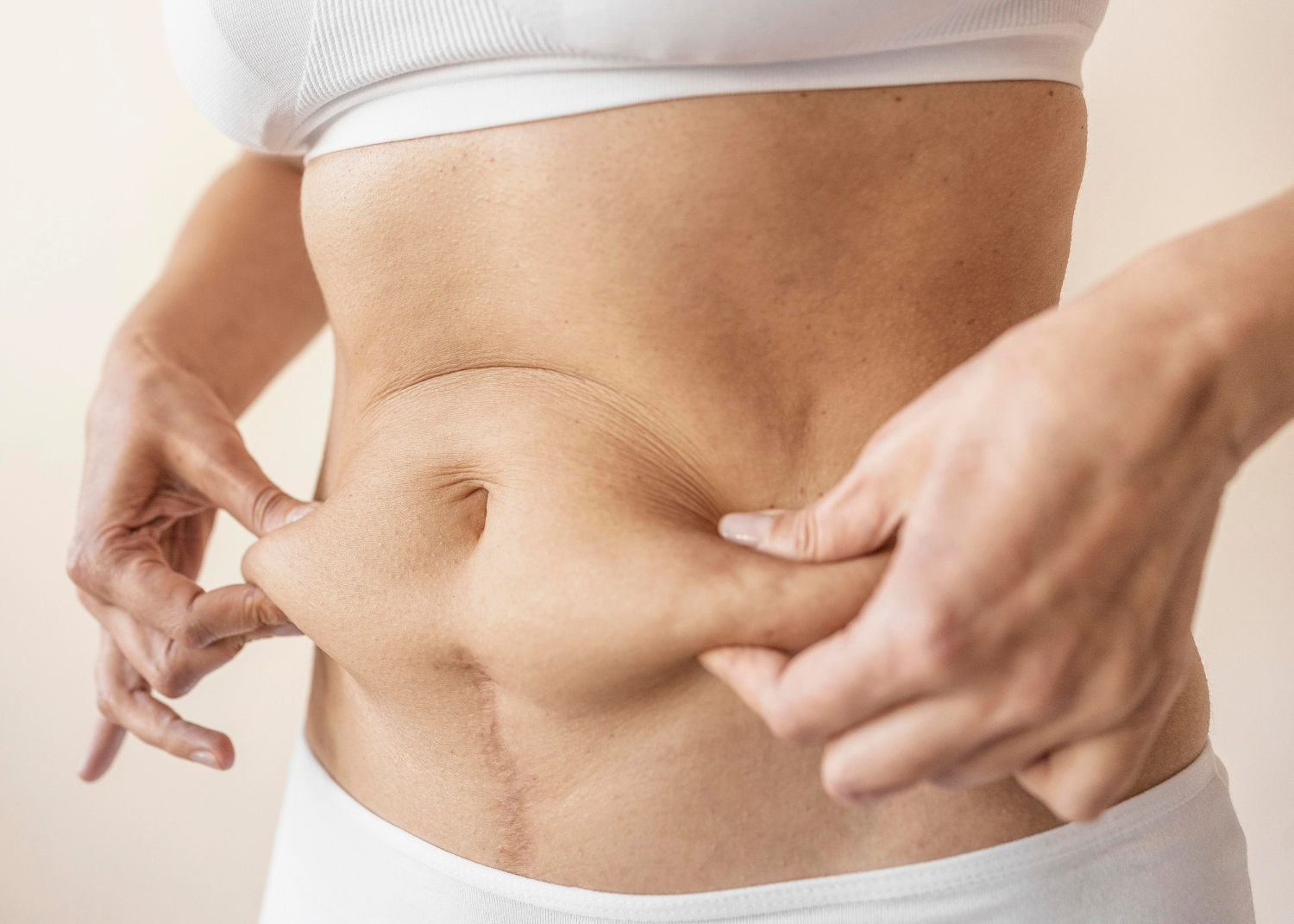 Abdominoplastyka – co to za zabieg i co powinnaś o nim wiedzieć?